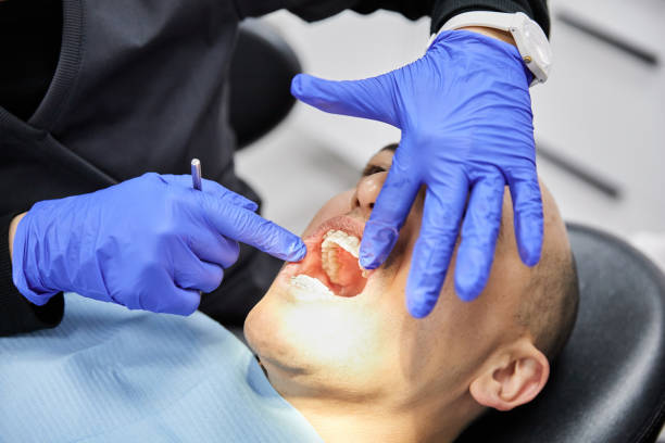 Best Emergency Broken Tooth Repair in The Woodlands, TX